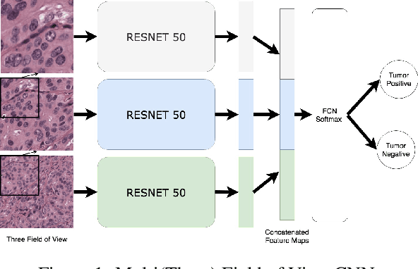 Figure 1 for Analysis Of Multi Field Of View Cnn And Attention Cnn On H&E Stained Whole-slide Images On Hepatocellular Carcinoma