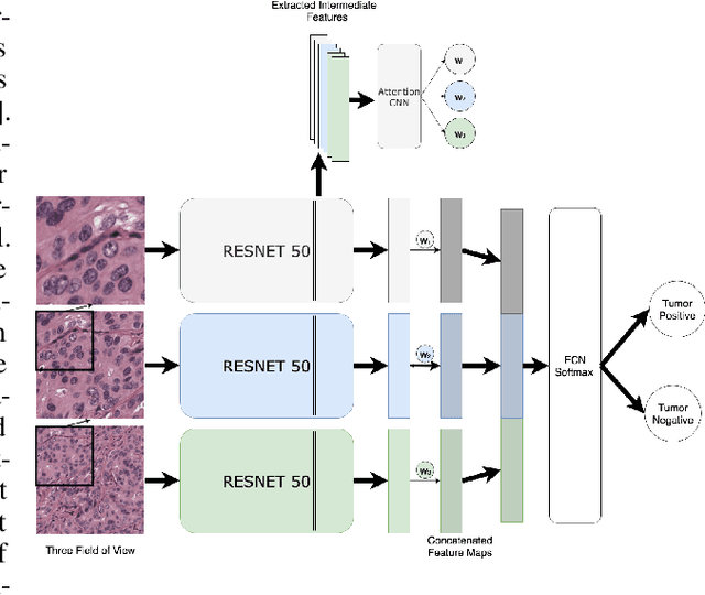 Figure 3 for Analysis Of Multi Field Of View Cnn And Attention Cnn On H&E Stained Whole-slide Images On Hepatocellular Carcinoma