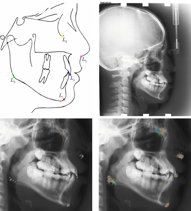 Figure 3 for Modeling Annotation Uncertainty with Gaussian Heatmaps in Landmark Localization