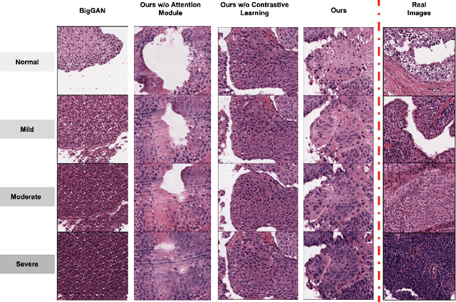 Figure 4 for A Multi-attribute Controllable Generative Model for Histopathology Image Synthesis