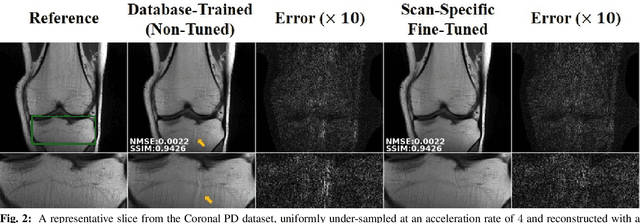 Figure 2 for High-Fidelity Accelerated MRI Reconstruction by Scan-Specific Fine-Tuning of Physics-Based Neural Networks
