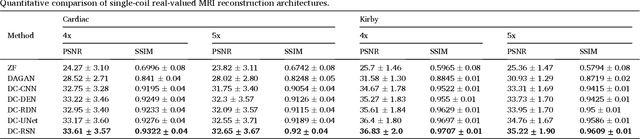 Figure 2 for A deep cascade of ensemble of dual domain networks with gradient-based T1 assistance and perceptual refinement for fast MRI reconstruction