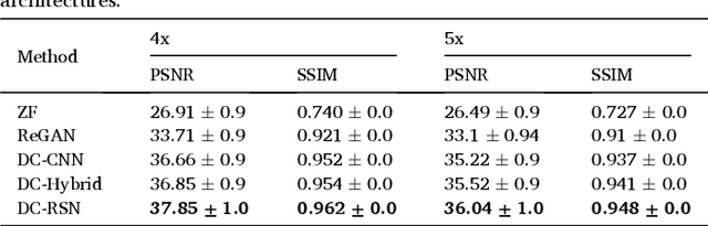 Figure 4 for A deep cascade of ensemble of dual domain networks with gradient-based T1 assistance and perceptual refinement for fast MRI reconstruction
