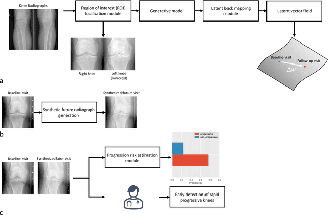 Figure 1 for Predicting Osteoarthritis Progression in Radiographs via Unsupervised Representation Learning