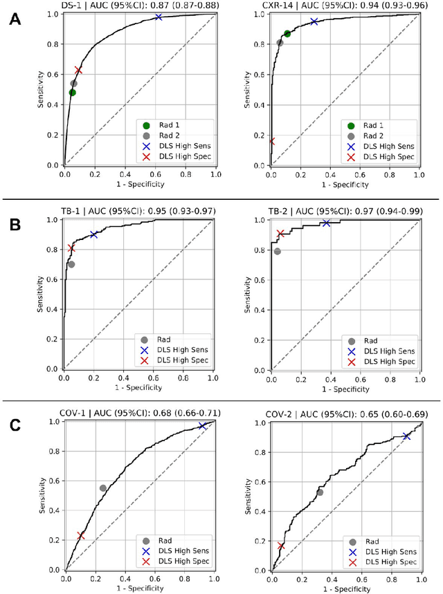 Figure 3 for Deep Learning for Distinguishing Normal versus Abnormal Chest Radiographs and Generalization to Unseen Diseases