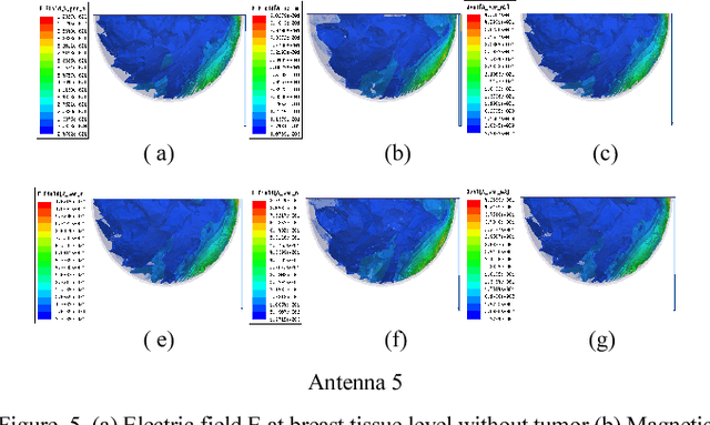 Figure 4 for Circular Antenna Array Design for Breast Cancer Detection