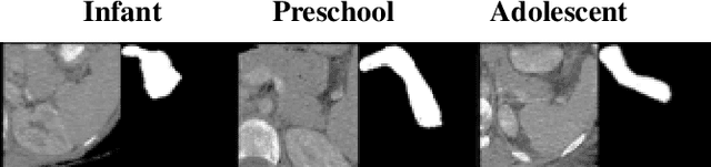Figure 4 for Age-Conditioned Synthesis of Pediatric Computed Tomography with Auxiliary Classifier Generative Adversarial Networks