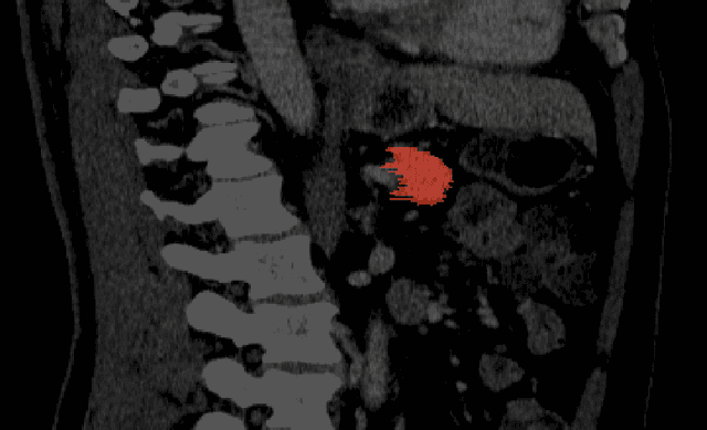 Figure 1 for Imperfect Segmentation Labels: How Much Do They Matter?