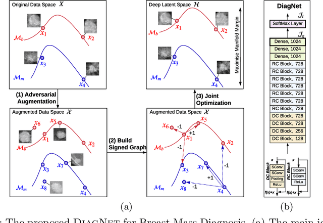 Figure 1 for Signed Laplacian Deep Learning with Adversarial Augmentation for Improved Mammography Diagnosis