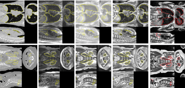 Figure 2 for Generative Adversarial Networks for MR-CT Deformable Image Registration