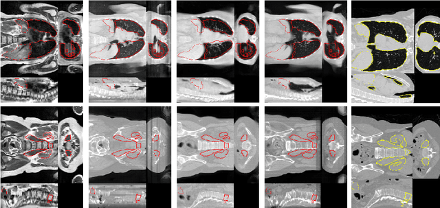 Figure 4 for Generative Adversarial Networks for MR-CT Deformable Image Registration