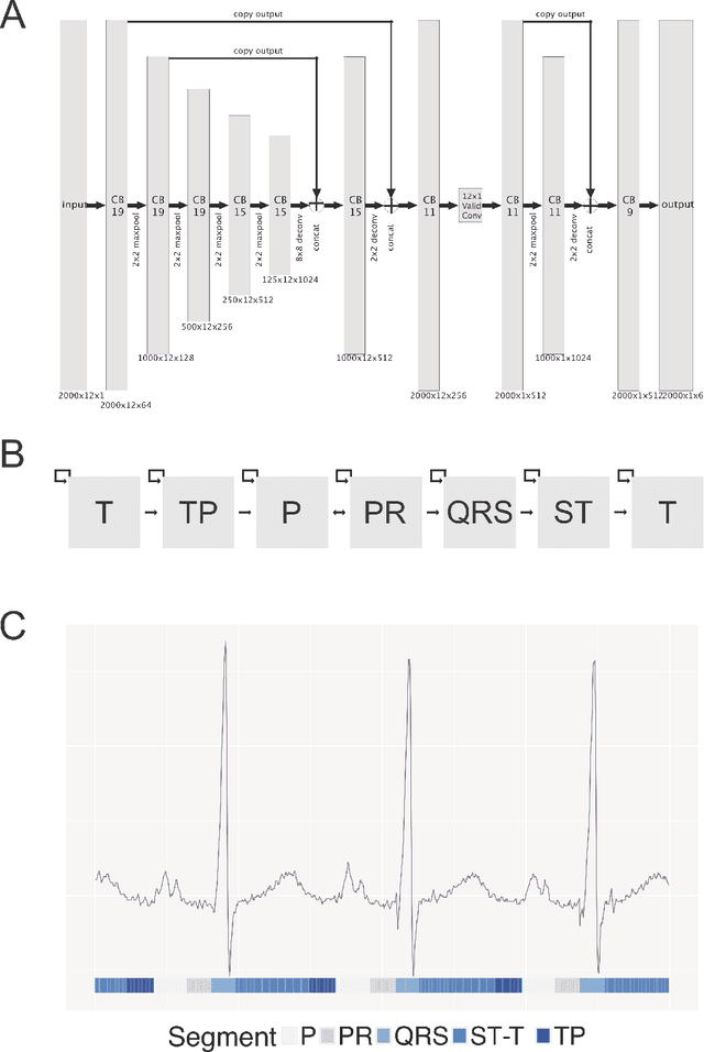 Figure 3 for Automated and Interpretable Patient ECG Profiles for Disease Detection, Tracking, and Discovery
