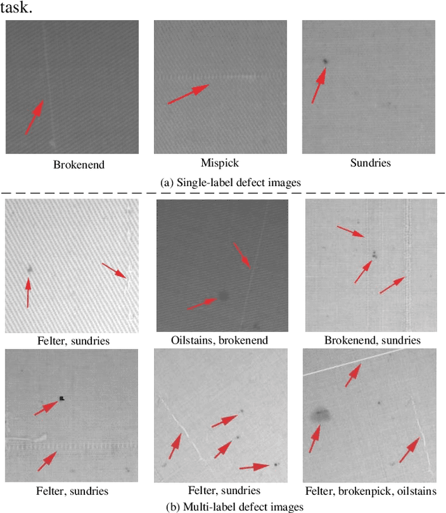 Figure 1 for MLMA-Net: multi-level multi-attentional learning for multi-label object detection in textile defect images