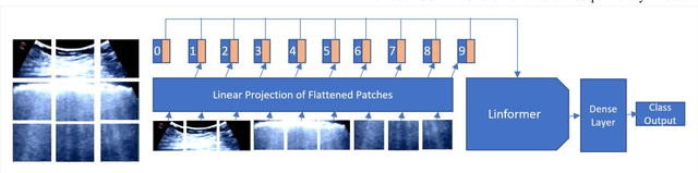 Figure 1 for POCFormer: A Lightweight Transformer Architecture for Detection of COVID-19 Using Point of Care Ultrasound