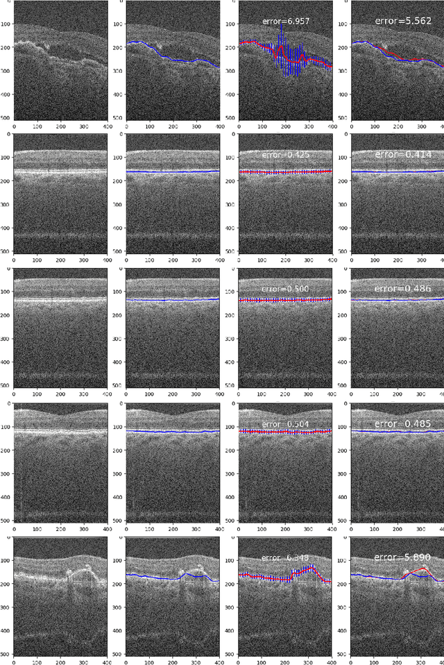 Figure 4 for Globally Optimal Surface Segmentation using Deep Learning with Learnable Smoothness Priors