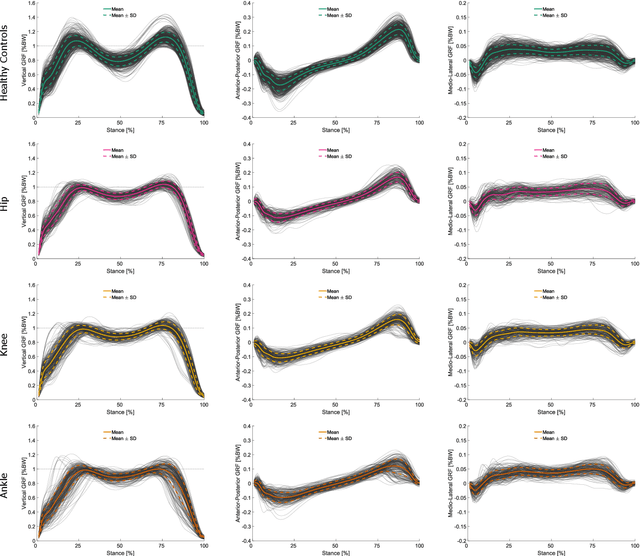 Figure 2 for On the Understanding and Interpretation of Machine Learning Predictions in Clinical Gait Analysis Using Explainable Artificial Intelligence