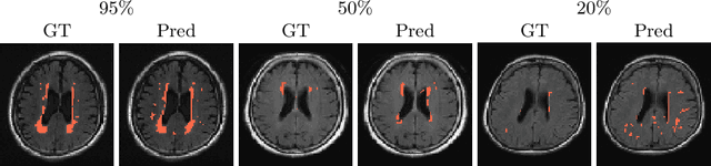 Figure 3 for PIMMS: Permutation Invariant Multi-Modal Segmentation
