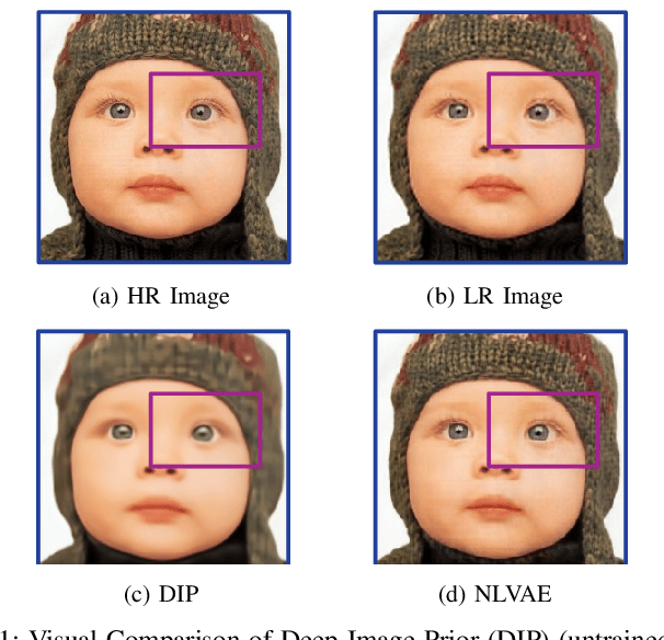 Figure 1 for Single Image Internal Distribution Measurement Using Non-Local Variational Autoencoder