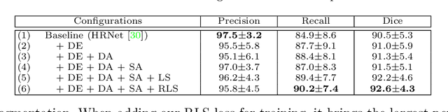 Figure 3 for Weakly-Supervised Universal Lesion Segmentation with Regional Level Set Loss