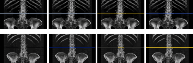 Figure 3 for Deep Reinforcement Learning for L3 Slice Localization in Sarcopenia Assessment