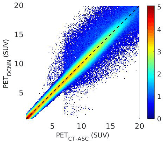 Figure 4 for Joint Correction of Attenuation and Scatter Using Deep Convolutional Neural Networks (DCNN) for Time-of-Flight PET