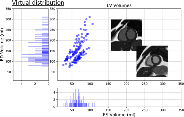 Figure 3 for sim2real: Cardiac MR Image Simulation-to-Real Translation via Unsupervised GANs
