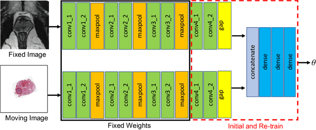 Figure 3 for Weakly Supervised Registration of Prostate MRI and Histopathology Images