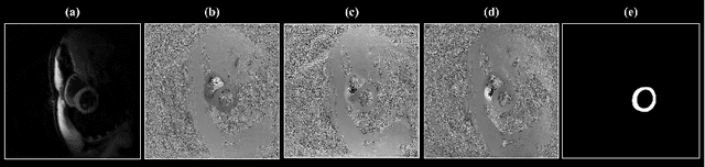 Figure 1 for Three-Dimensional Embedded Attentive RNN (3D-EAR) Segmentor for Left Ventricle Delineation from Myocardial Velocity Mapping