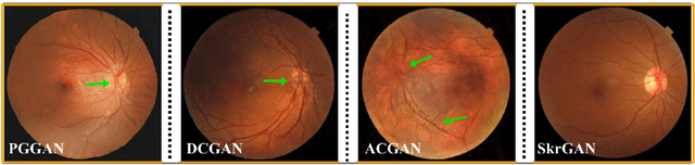 Figure 1 for SkrGAN: Sketching-rendering Unconditional Generative Adversarial Networks for Medical Image Synthesis