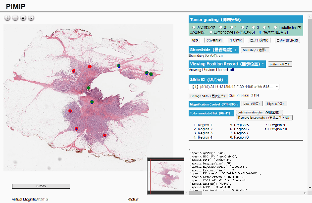 Figure 2 for PIMIP: An Open Source Platform for Pathology Information Management and Integration