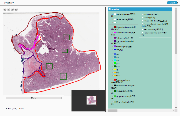 Figure 3 for PIMIP: An Open Source Platform for Pathology Information Management and Integration