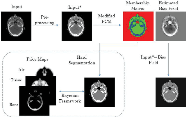 Figure 1 for A modified fuzzy C means algorithm for shading correction in craniofacial CBCT images
