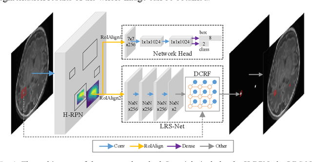 Figure 1 for Refined-Segmentation R-CNN: A Two-stage Convolutional Neural Network for Punctate White Matter Lesion Segmentation in Preterm Infants