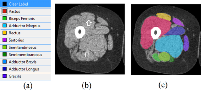 Figure 1 for Semantic Segmentation of Thigh Muscle using 2.5D Deep Learning Network Trained with Limited Datasets