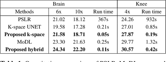 Figure 2 for Calibrationless Parallel MRI using Model based Deep Learning (C-MODL)