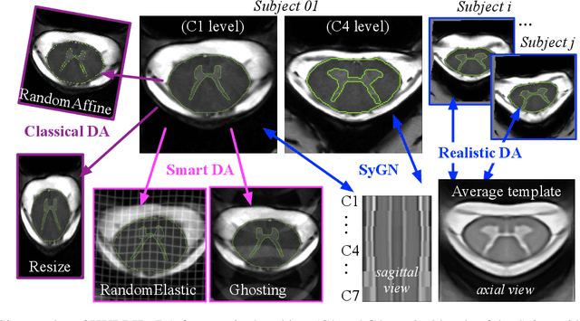 Figure 4 for 2D Multi-Class Model for Gray and White Matter Segmentation of the Cervical Spinal Cord at 7T