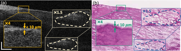 Figure 1 for Multi-scale reconstruction of undersampled spectral-spatial OCT data for coronary imaging using deep learning