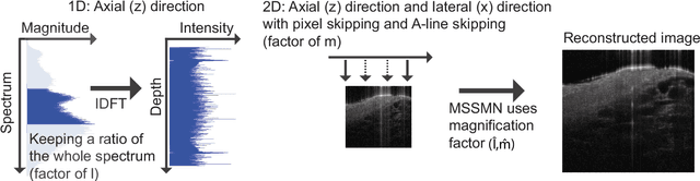 Figure 2 for Multi-scale reconstruction of undersampled spectral-spatial OCT data for coronary imaging using deep learning