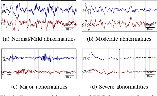Figure 2 for Grading the severity of hypoxic-ischemic encephalopathy in newborn EEG using a convolutional neural network
