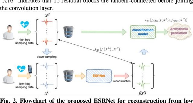 Figure 2 for ECG Signal Super-resolution by Considering Reconstruction and Cardiac Arrhythmias Classification Loss