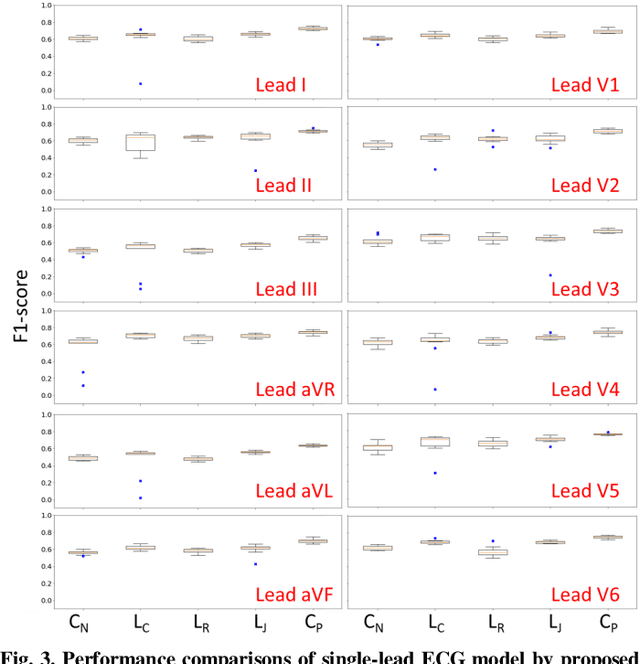 Figure 3 for ECG Signal Super-resolution by Considering Reconstruction and Cardiac Arrhythmias Classification Loss