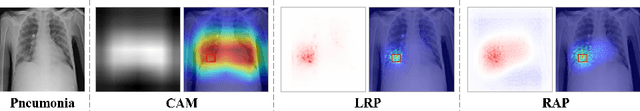 Figure 1 for Improving Interpretability of Deep Neural Networks in Medical Diagnosis by Investigating the Individual Units