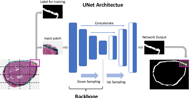 Figure 1 for Ink Marker Segmentation in Histopathology Images Using Deep Learning