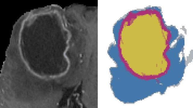 Figure 3 for Morphology on categorical distributions