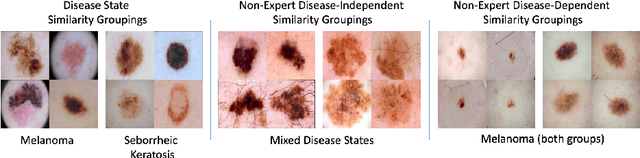 Figure 3 for Collaborative Human-AI (CHAI): Evidence-Based Interpretable Melanoma Classification in Dermoscopic Images