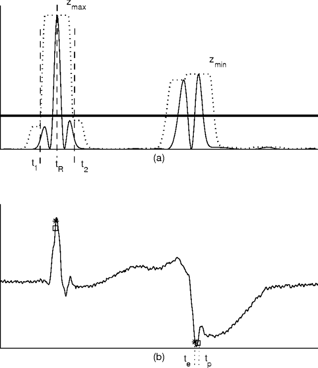 Figure 2 for Comparisons of wavelet functions in QRS signal to noise ratio enhancement and detection accuracy