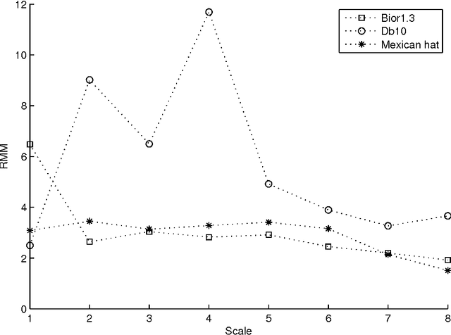 Figure 3 for Comparisons of wavelet functions in QRS signal to noise ratio enhancement and detection accuracy