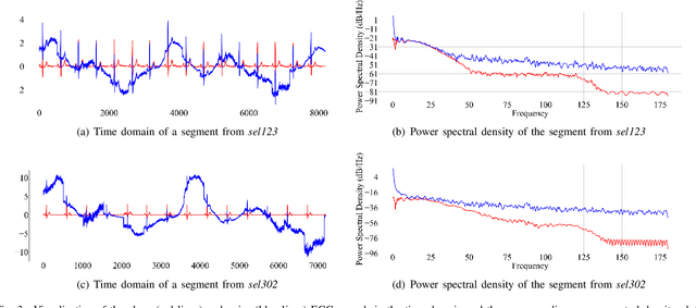 Figure 3 for DeScoD-ECG: Deep Score-Based Diffusion Model for ECG Baseline Wander and Noise Removal
