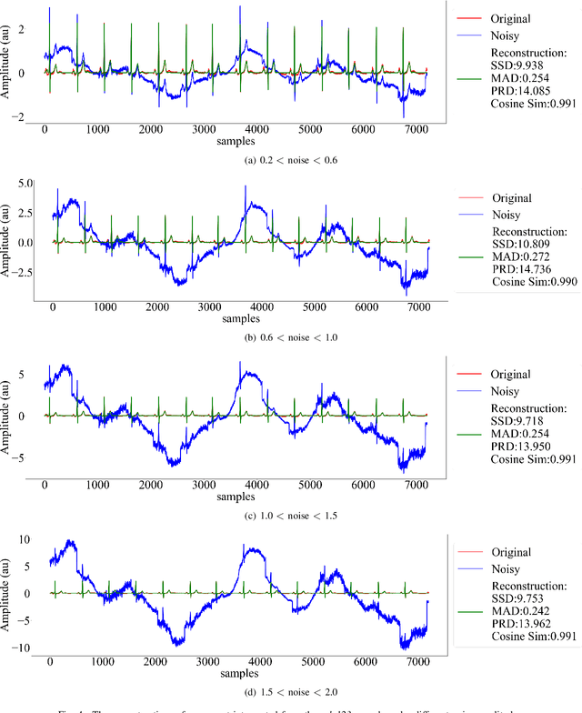 Figure 4 for DeScoD-ECG: Deep Score-Based Diffusion Model for ECG Baseline Wander and Noise Removal