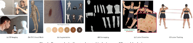 Figure 1 for Detection and Longitudinal Tracking of Pigmented Skin Lesions in 3D Total-Body Skin Textured Meshes